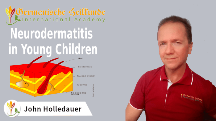 Neurodermitis und ernährung bei kindern