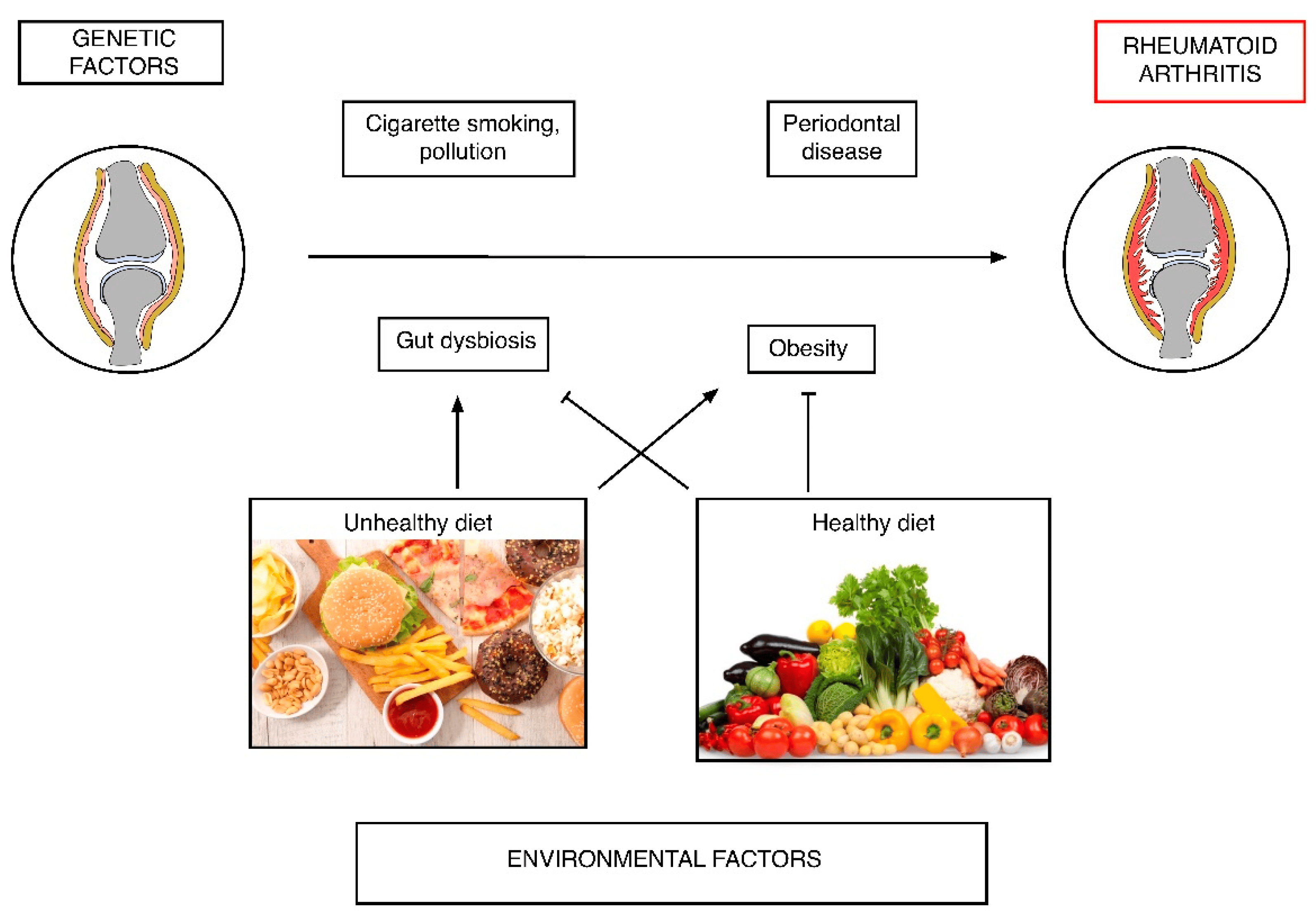 Rheuma bei kindern ernährung