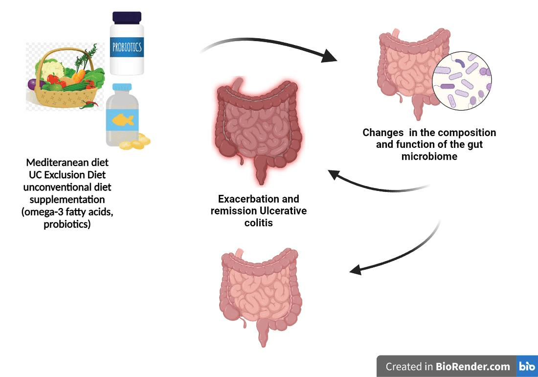 Ernährung kinder colitis ulcerosa